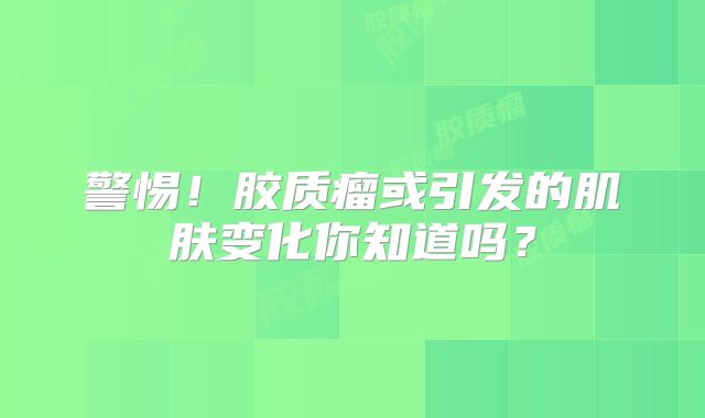 警惕！胶质瘤或引发的肌肤变化你知道吗？
