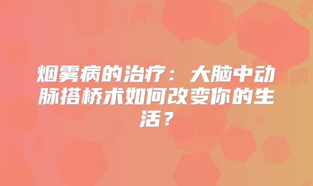 烟雾病的治疗：大脑中动脉搭桥术如何改变你的生活？