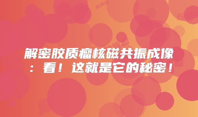 解密胶质瘤核磁共振成像：看！这就是它的秘密！