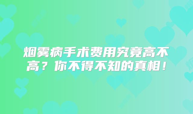 烟雾病手术费用究竟高不高？你不得不知的真相！