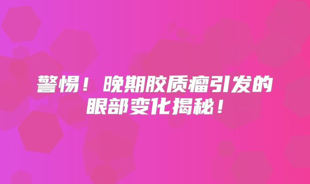 警惕！晚期胶质瘤引发的眼部变化揭秘！