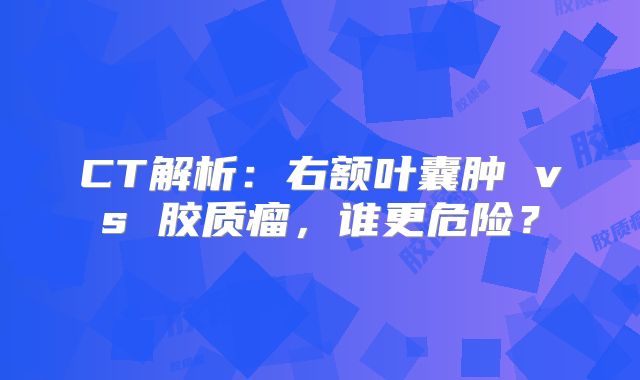 CT解析：右额叶囊肿 vs 胶质瘤，谁更危险？