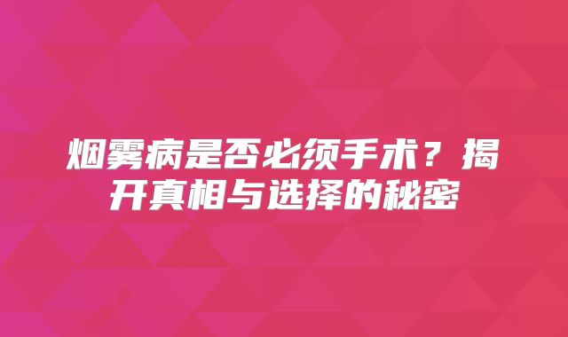 烟雾病是否必须手术？揭开真相与选择的秘密