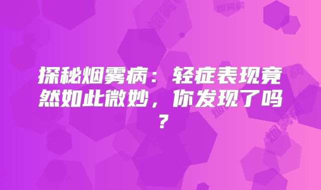 探秘烟雾病：轻症表现竟然如此微妙，你发现了吗？