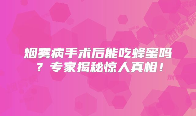 烟雾病手术后能吃蜂蜜吗？专家揭秘惊人真相！
