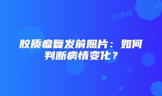 胶质瘤复发前照片：如何判断病情变化？