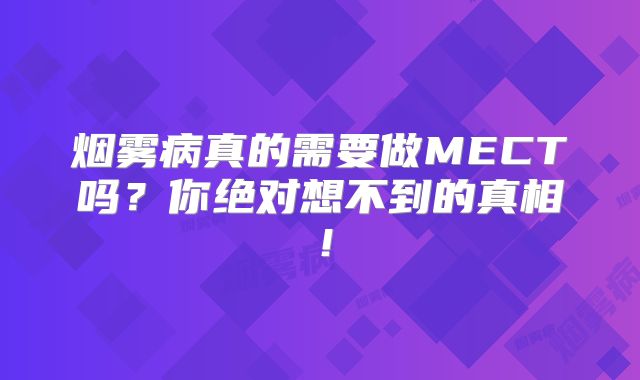 烟雾病真的需要做MECT吗？你绝对想不到的真相！
