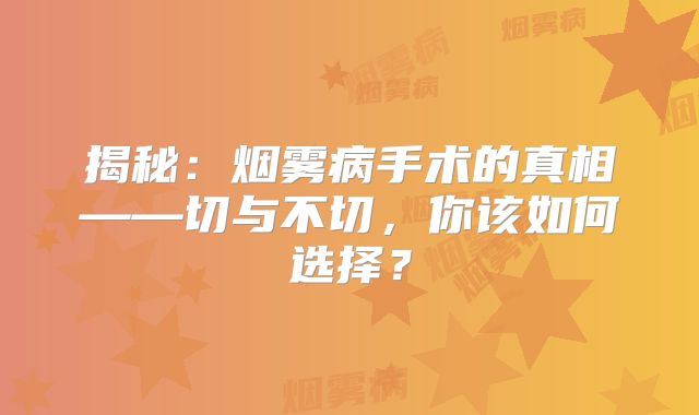 揭秘：烟雾病手术的真相——切与不切，你该如何选择？