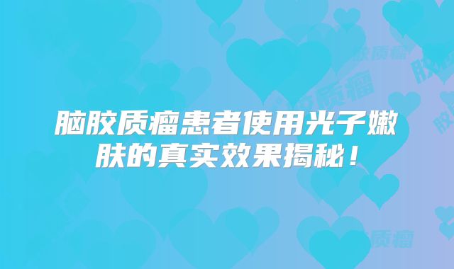 脑胶质瘤患者使用光子嫩肤的真实效果揭秘！