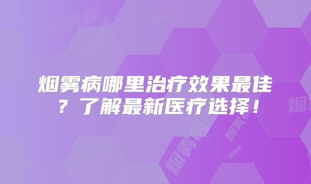 烟雾病哪里治疗效果最佳？了解最新医疗选择！