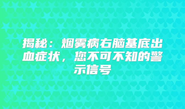 揭秘：烟雾病右脑基底出血症状，您不可不知的警示信号
