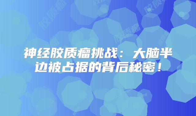 神经胶质瘤挑战：大脑半边被占据的背后秘密！