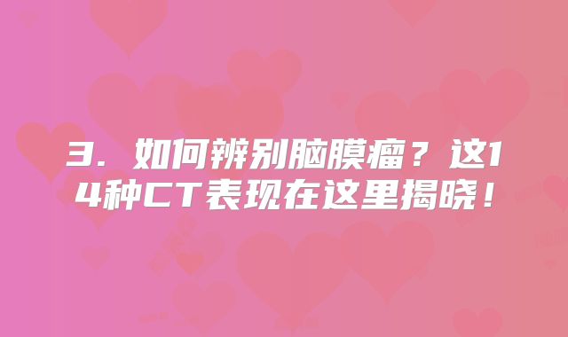 3. 如何辨别脑膜瘤？这14种CT表现在这里揭晓！