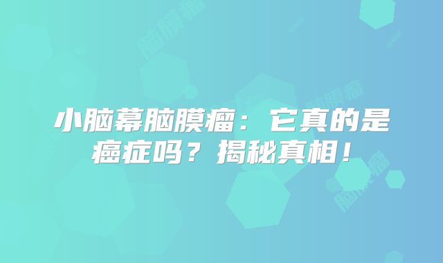 小脑幕脑膜瘤：它真的是癌症吗？揭秘真相！
