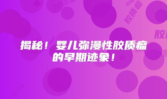 揭秘！婴儿弥漫性胶质瘤的早期迹象！