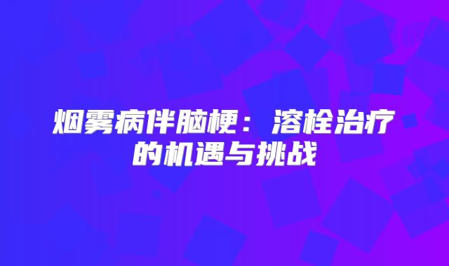 烟雾病伴脑梗：溶栓治疗的机遇与挑战