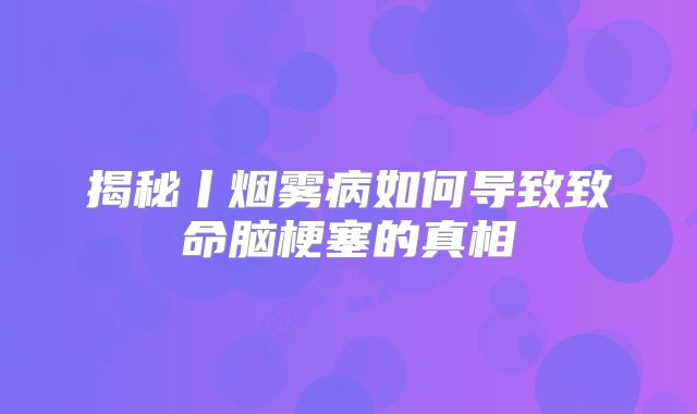 揭秘丨烟雾病如何导致致命脑梗塞的真相