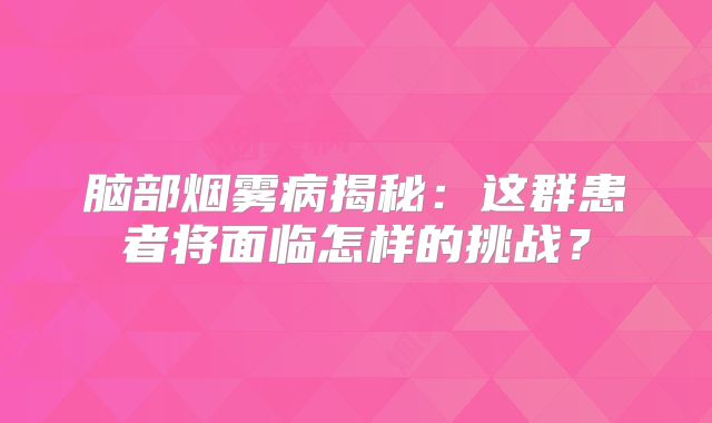 脑部烟雾病揭秘：这群患者将面临怎样的挑战？
