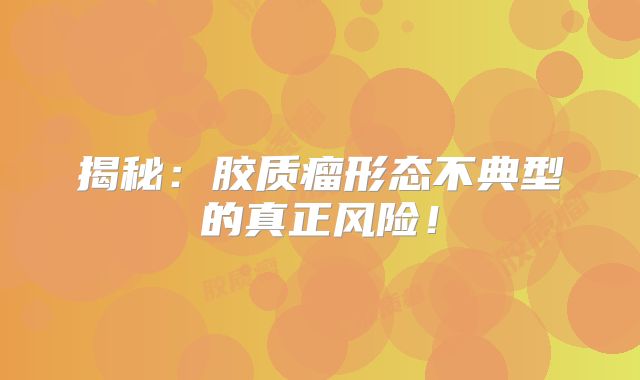 揭秘：胶质瘤形态不典型的真正风险！