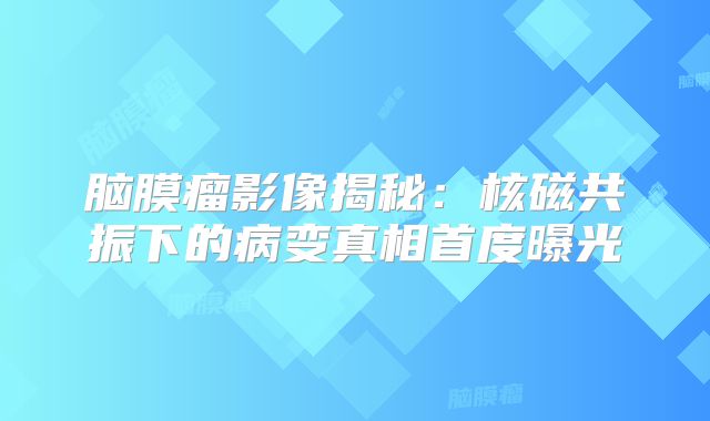 脑膜瘤影像揭秘：核磁共振下的病变真相首度曝光