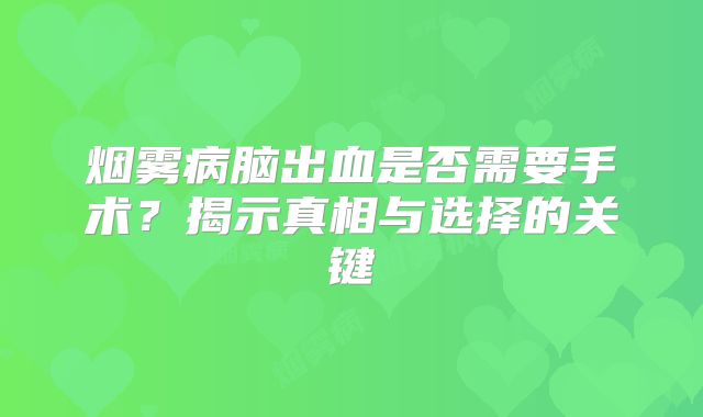 烟雾病脑出血是否需要手术？揭示真相与选择的关键