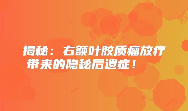 揭秘：右额叶胶质瘤放疗带来的隐秘后遗症！  