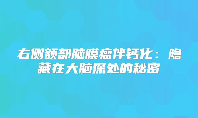 右侧额部脑膜瘤伴钙化：隐藏在大脑深处的秘密