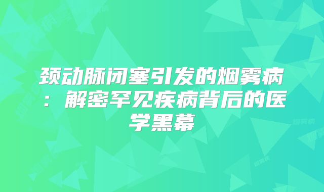 颈动脉闭塞引发的烟雾病：解密罕见疾病背后的医学黑幕