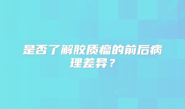 是否了解胶质瘤的前后病理差异？