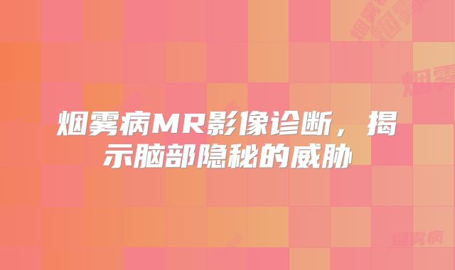 烟雾病MR影像诊断，揭示脑部隐秘的威胁