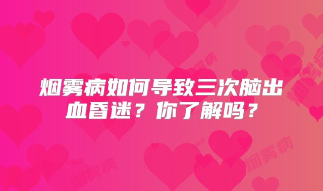烟雾病如何导致三次脑出血昏迷？你了解吗？