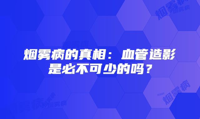 烟雾病的真相：血管造影是必不可少的吗？