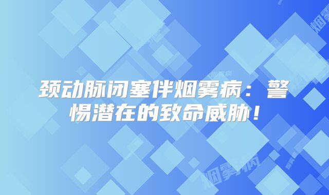 颈动脉闭塞伴烟雾病：警惕潜在的致命威胁！