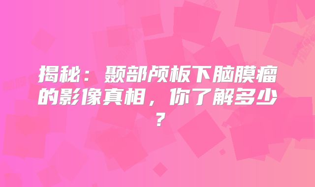 揭秘：颞部颅板下脑膜瘤的影像真相，你了解多少？