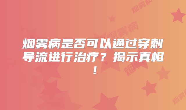 烟雾病是否可以通过穿刺导流进行治疗？揭示真相！