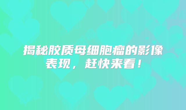 揭秘胶质母细胞瘤的影像表现，赶快来看！