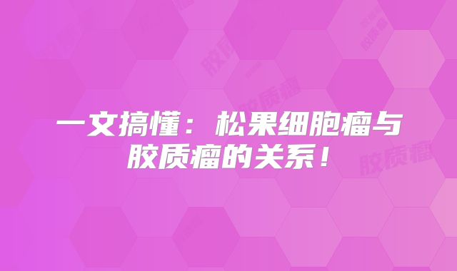 一文搞懂：松果细胞瘤与胶质瘤的关系！
