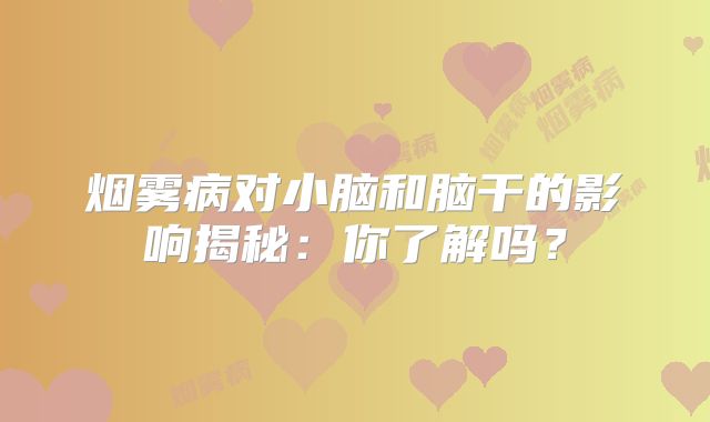 烟雾病对小脑和脑干的影响揭秘：你了解吗？
