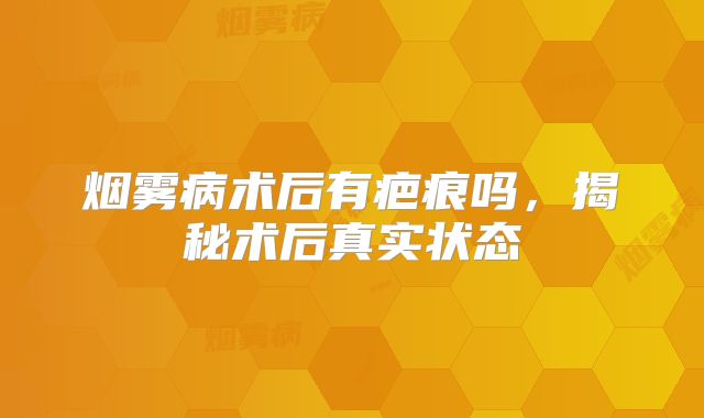 烟雾病术后有疤痕吗，揭秘术后真实状态