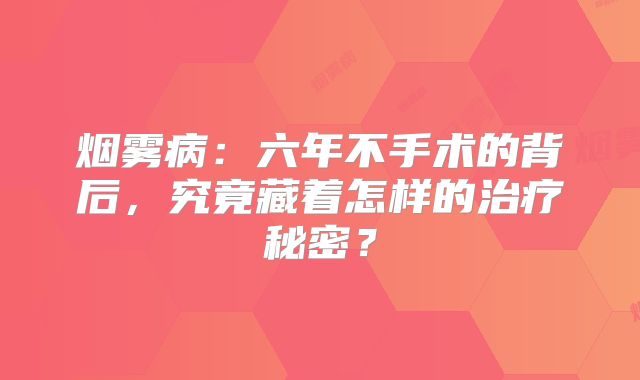 烟雾病：六年不手术的背后，究竟藏着怎样的治疗秘密？