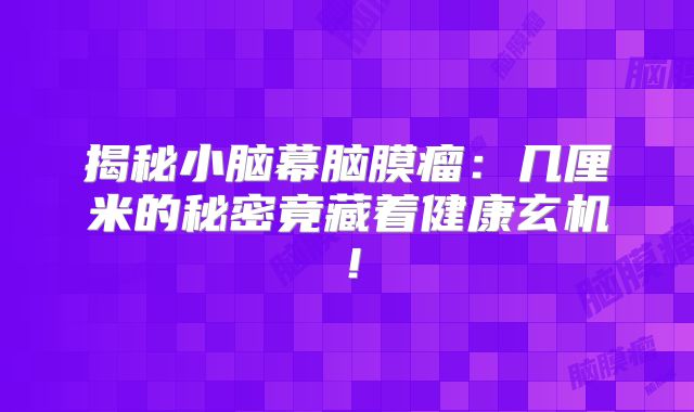 揭秘小脑幕脑膜瘤：几厘米的秘密竟藏着健康玄机！