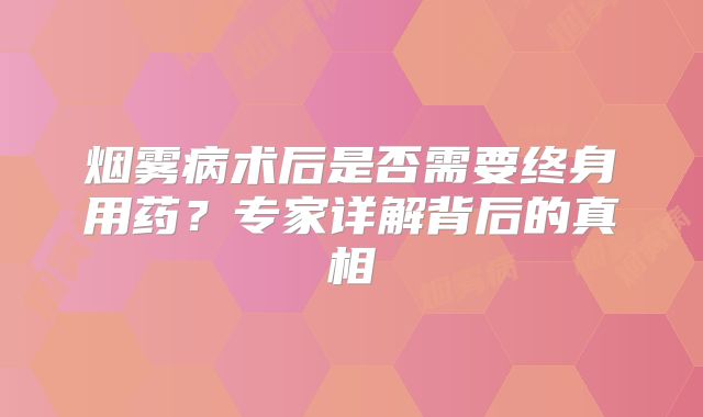 烟雾病术后是否需要终身用药？专家详解背后的真相