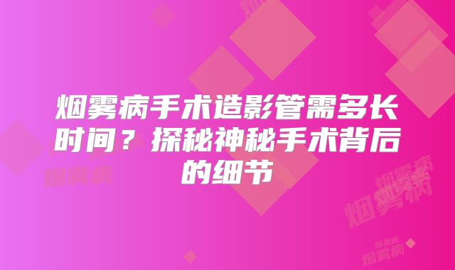 烟雾病手术造影管需多长时间？探秘神秘手术背后的细节