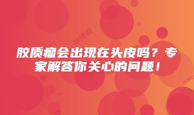 胶质瘤会出现在头皮吗？专家解答你关心的问题！