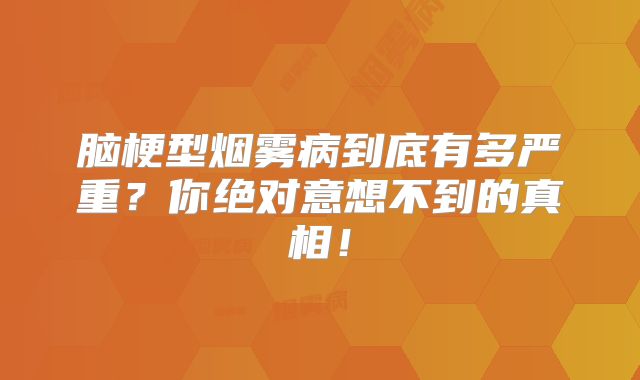 脑梗型烟雾病到底有多严重？你绝对意想不到的真相！