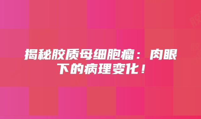 揭秘胶质母细胞瘤：肉眼下的病理变化！