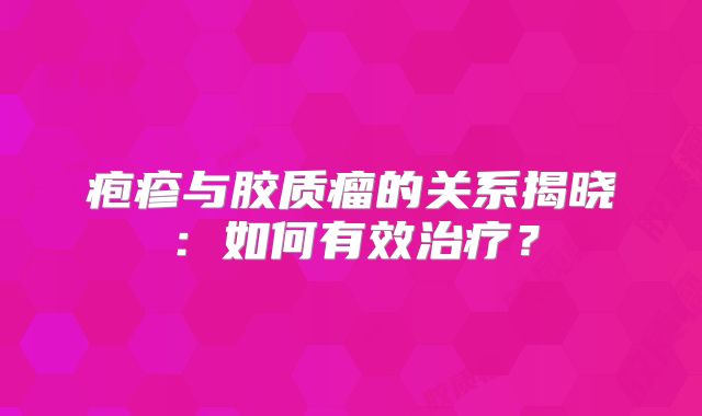 疱疹与胶质瘤的关系揭晓：如何有效治疗？