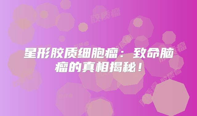 星形胶质细胞瘤：致命脑瘤的真相揭秘！