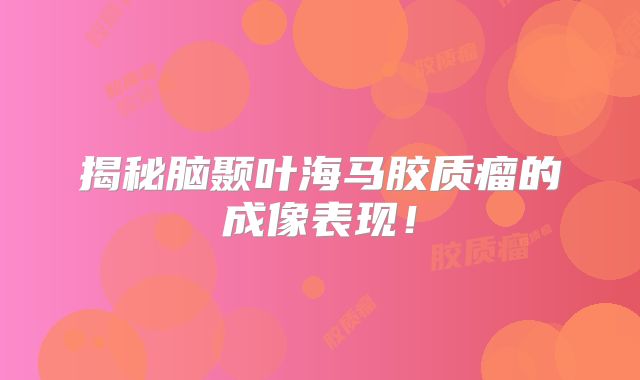 揭秘脑颞叶海马胶质瘤的成像表现！
