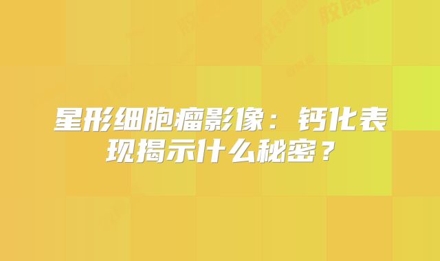 星形细胞瘤影像：钙化表现揭示什么秘密？
